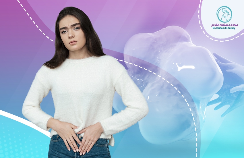 انواع-اكياس-المبيض أنواع أكياس المبيض: نظرة شاملة على الأعراض والأسباب والعلاج