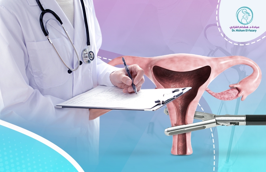 نصائح بعد عملية استئصال الرحم: كيف ستتغير حياتك؟