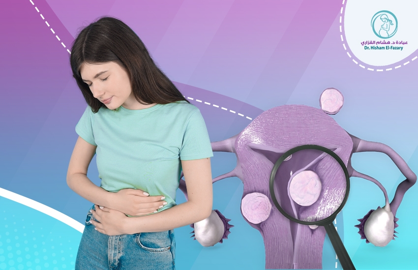 أعراض-الأورام-الليفية-في-الرحم أعراض الأورام الليفية في الرحم