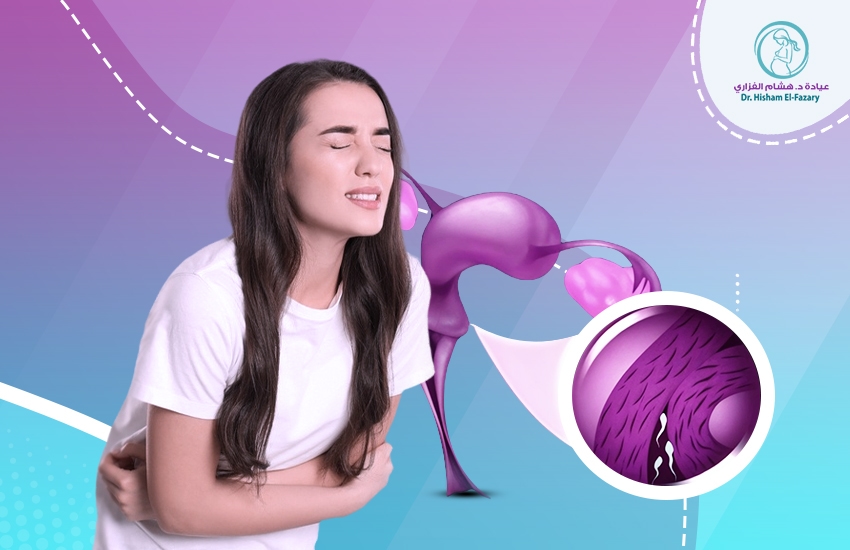 أعراض سقوط الرحم