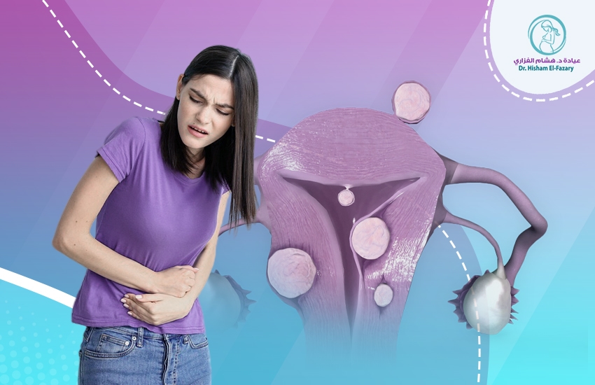 الاورام-الليفية-في-الرحم الاورام الليفية في الرحم