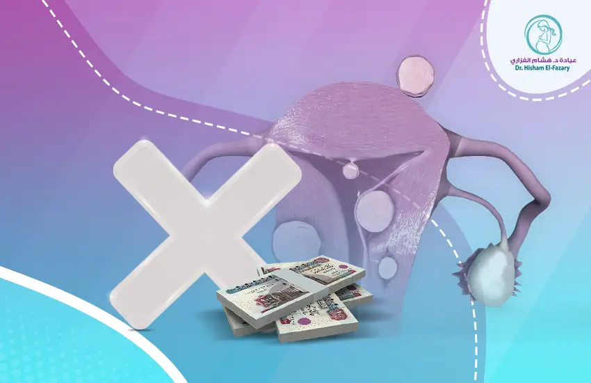 تكلفة عملية إزالة الورم الليفي في الرحم 2026