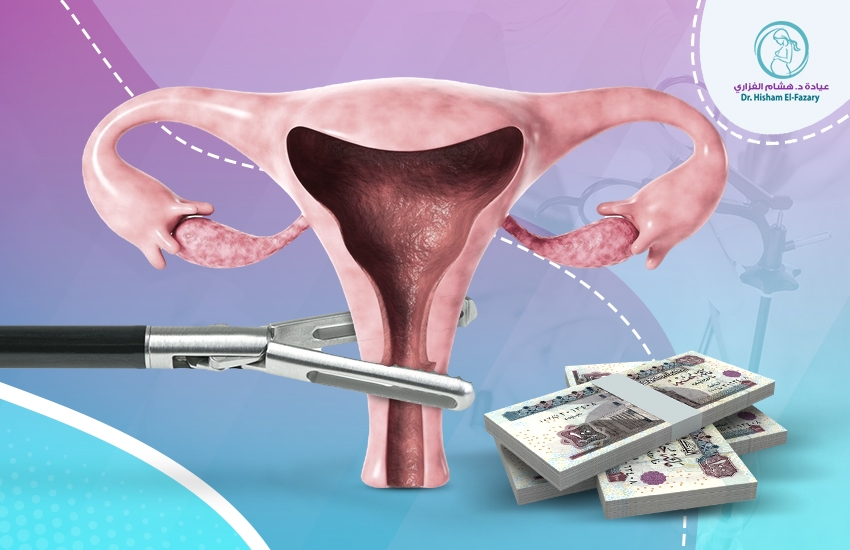 تكلفة-عملية-استئصال-الرحم-بالمنظار العوامل المؤثرة في تكلفة عملية استئصال الرحم بالمنظار