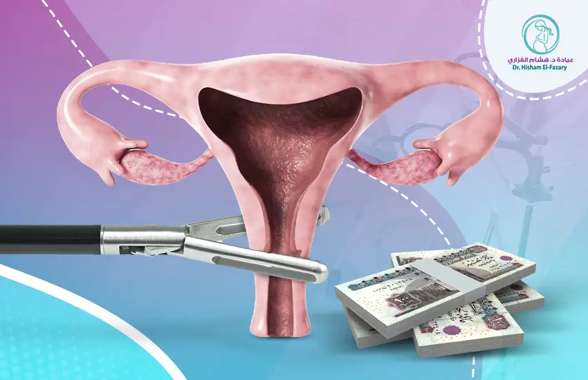 العوامل المؤثرة في تكلفة عملية استئصال الرحم بالمنظار 2026
