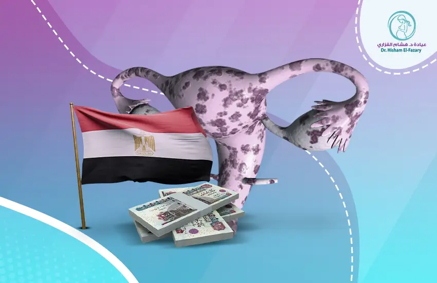 تكلفة عملية بطانة الرحم المهاجرة في مصر