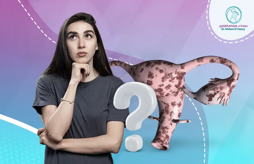 ما-هي-طرق-علاج-بطانة-الرحم-المهاجرة علاج بطانة الرحم المهاجرة