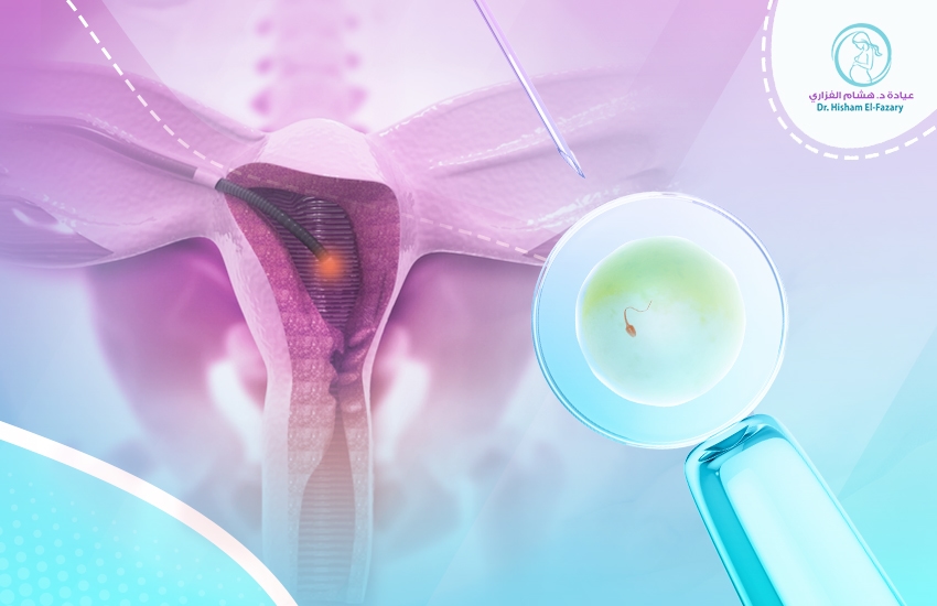 منظار-الرحم-قبل-الحقن-المجهري هل يجب الخضوع إلى منظار الرحم قبل الحقن المجهري؟