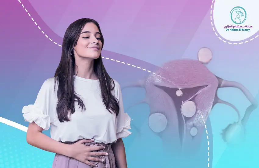 تجربتي في القضاء على الورم الليفي