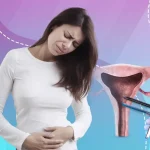 أعراض ما بعد عملية تنظيف الرحم