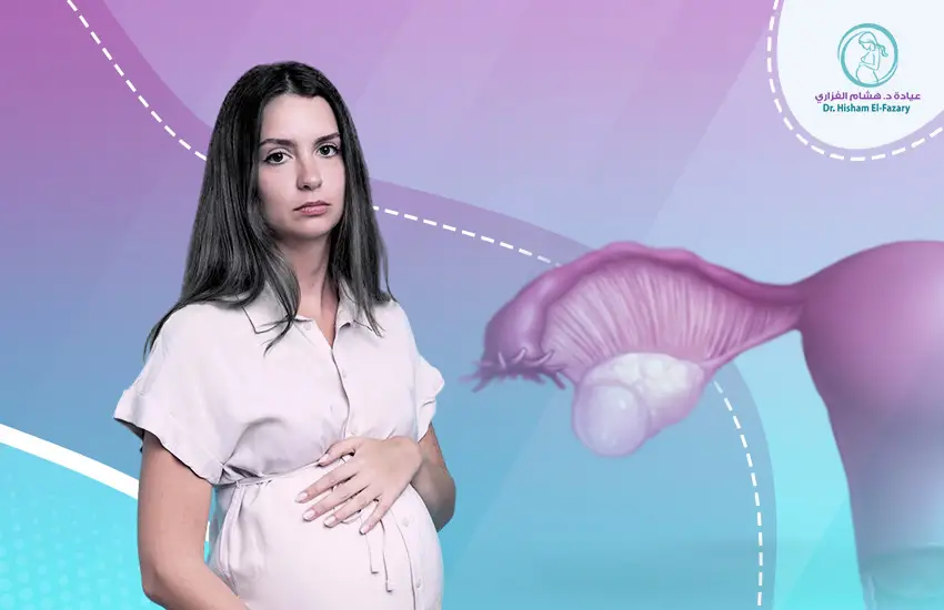 تجارب الحمل مع وجود كيس على المبيض