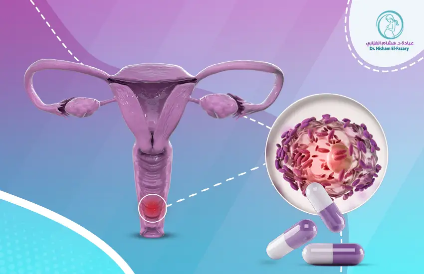 علاج التهابات المهبل