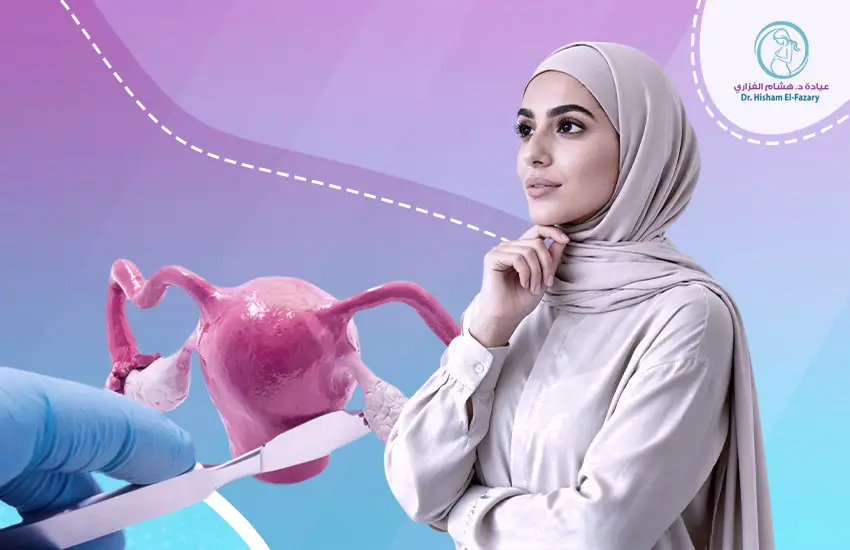 متى يجب إزالة كيس المبيض