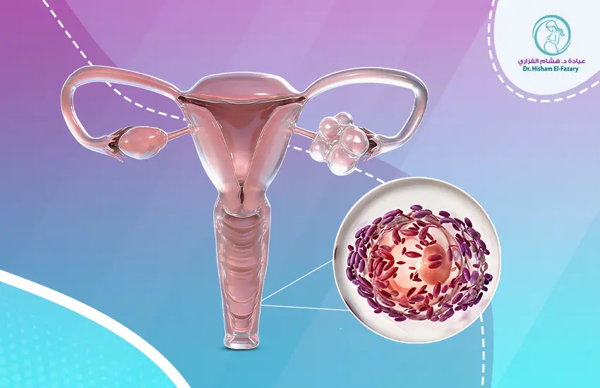 أسباب التهاب المهبل