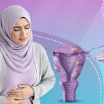 أعراض تليف الرحم