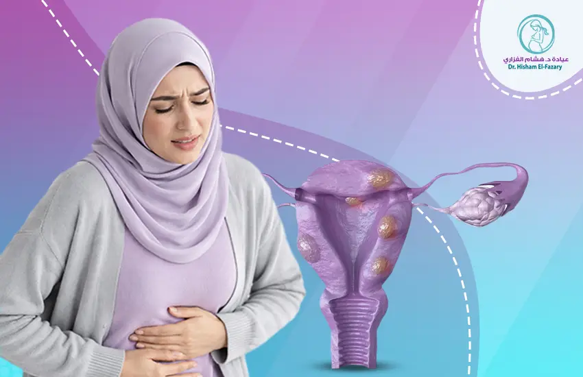 أعراض تليف الرحم